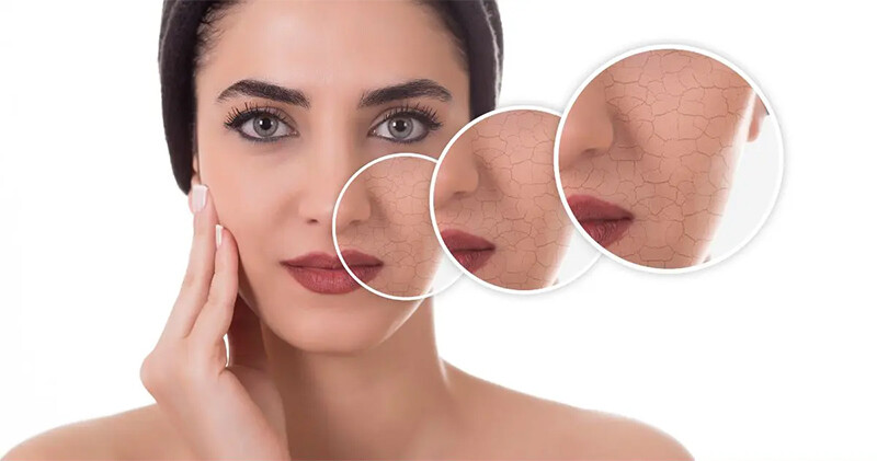 Những sai lầm cần tránh khi chăm sóc da bị nhăn nheo và khô mà các bạn nên biết.