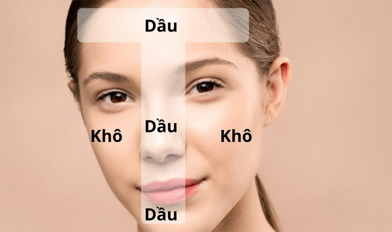 Da khô có đổ dầu không? Cách nhận biết da khô bị đổ dầu.