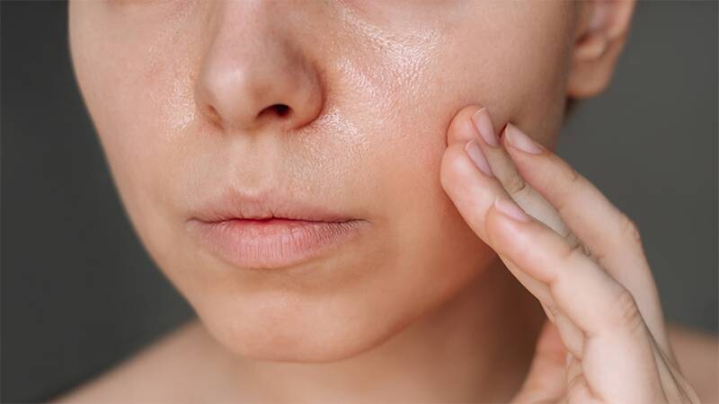 Da khô có đổ dầu không? Vào ngày hanh khô hoặc phòng độ ẩm thấp, có thể kích thích da khô tiết dầu.