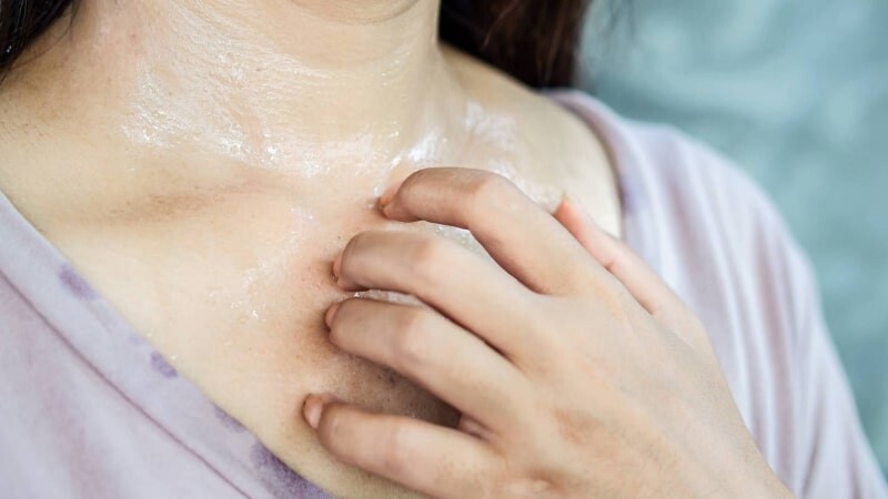 Mồ hôi muối tốt hay xấu? Cách trị mồ hôi muối tại nhà đơn giản.