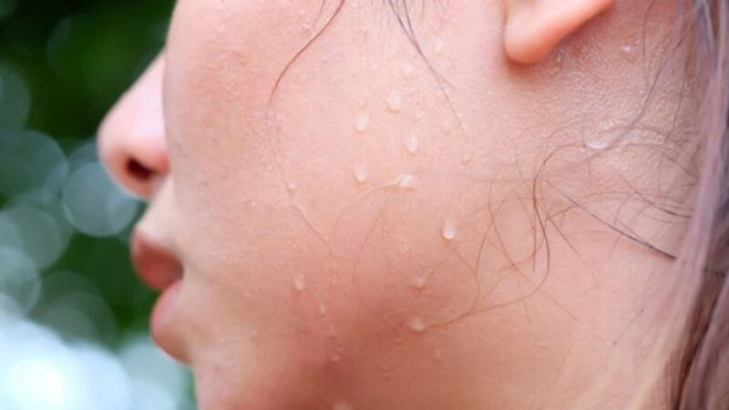 Mồ hôi muối tốt hay xấu? Mách bạn cách chăm sóc da khi đổ mồ hôi muối khoa học.