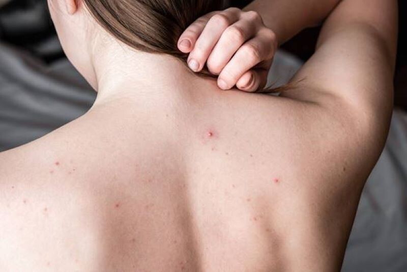 Nguyen Nhan Lung Noi Mun Do