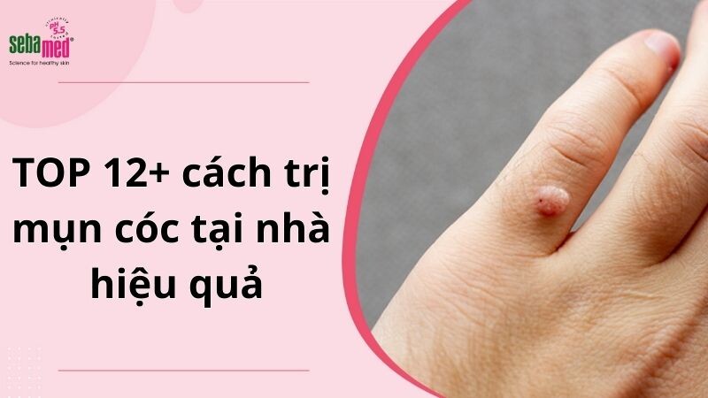Cach Tri Mun Coc Tai Nha