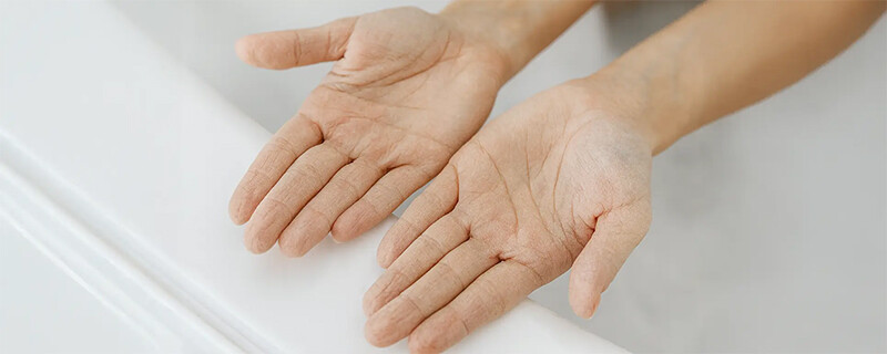 Mách bạn 5 cách chăm sóc da tay nhăn nheo và khô hiệu quả 1 - 1 Một số nguyên nhân khiến da tay nhăn nheo và khô.