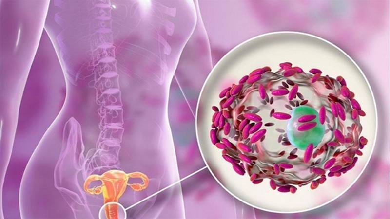 Viêm nhiễm phụ khoa có tự khỏi được không? 1 - 1 Viêm nhiễm phụ khoa là gì? Viêm nhiễm phụ khoa có tự khỏi được không?