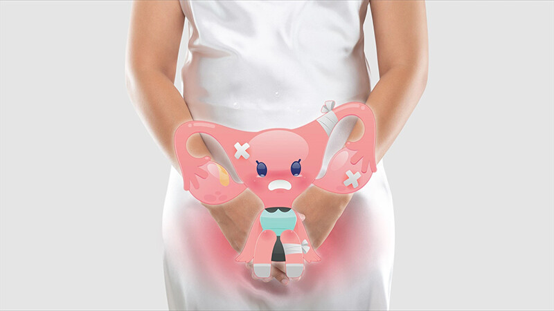 Viêm nhiễm phụ khoa có tự khỏi được không? 2 - 2 Nguyên nhân gây viêm phụ khoa là gì? Viêm nhiễm phụ khoa có tự khỏi được không?