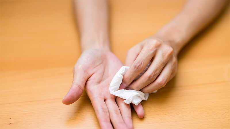 Bệnh ra mồ hôi tay chân có di truyền không? và phân loại bệnh ra mồ hôi tay chân.