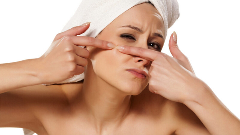 Nặn mụn xong có nên dùng sữa rửa mặt? Giải đáp từ các chuyên gia 2026 2 - 2 Nặn mụn xong có nên dùng sữa rửa mặt? Nếu nặn mụn nhẹ nhàng thì có thể dùng sau 4-6 giờ.