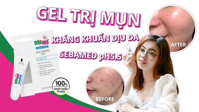 Nên dùng Gel trị mụn hay kem trị mụn? Gel chấm mụn Sebamed phù hợp với nhiều tình trạng da.