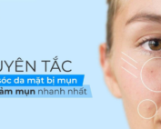 6 Nguyên Tắc Chăm Sóc Da Mụn – www.sebamed.com.vn