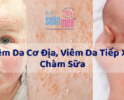 Viêm Da Tiếp Xúc