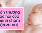 Tổn thương tác hại của bệnh chàm eczema