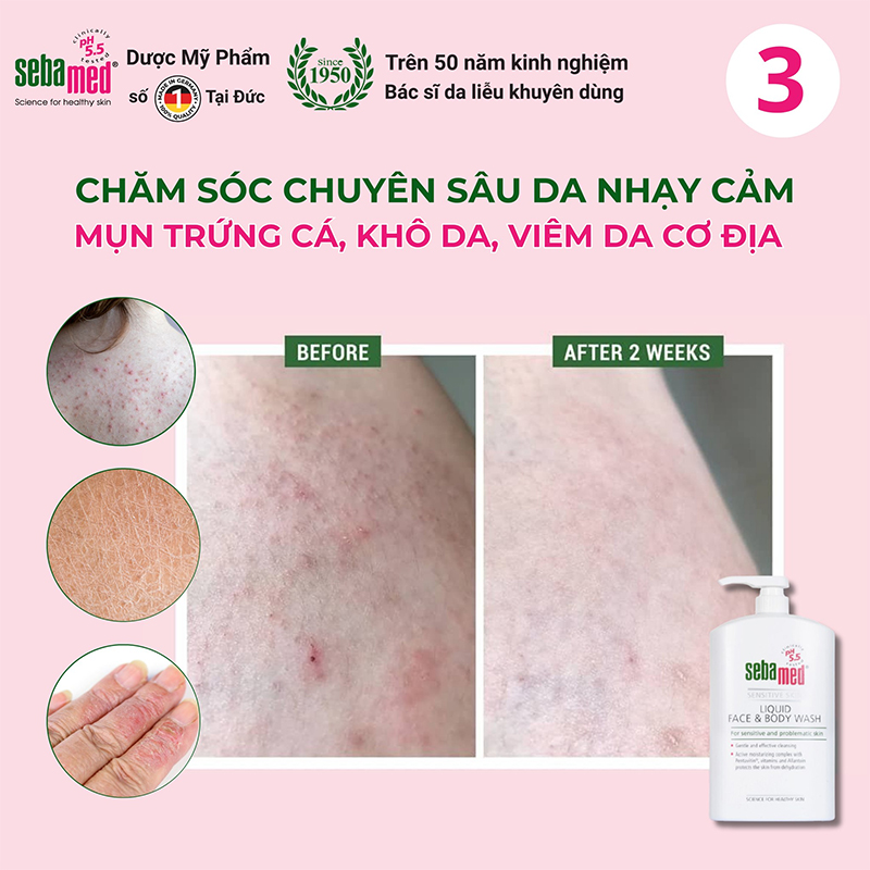 Sữa rửa mặt & tắm toàn thân sebamed: bí mật da khỏe từ đức - 6 - sebamed Sử dụng Sữa rửa mặt và sữa tắm toàn thân giúp da mềm mịn, phù hợp với da kích ứng, nhạy cảm.