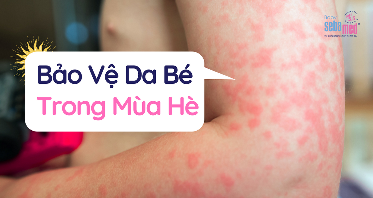 Bảo Vệ Da Bé Trong Mùa Hè