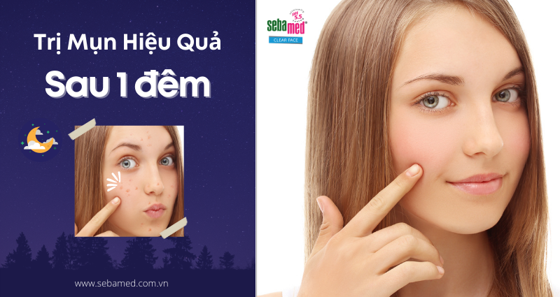 Cách trị thâm mụn nhanh sau một đêm