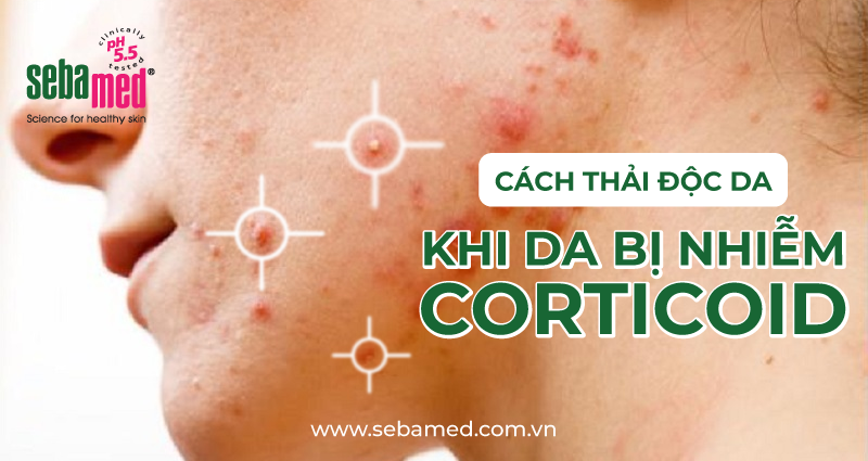 3 Cách Thải Độc Da Nhiễm Corticoid