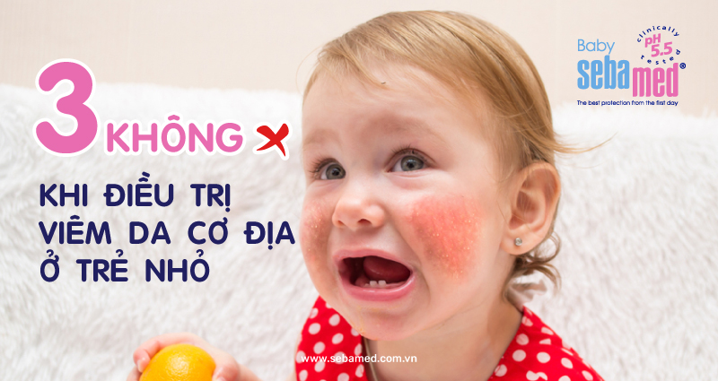 3 KHÔNG! Khi Điều Trị Viêm Da Cơ Địa Ở Trẻ