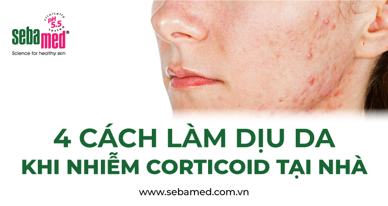4 Cách làm dịu da bị Corticoid tại nhà