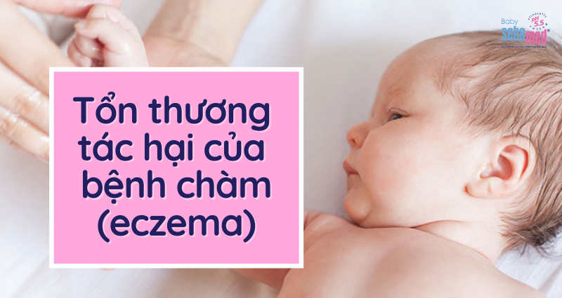 Tổn thương tác hại của bệnh chàm eczema