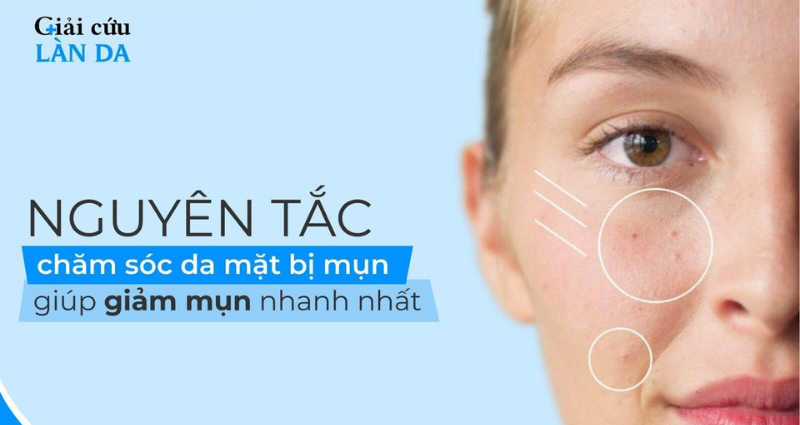 6+ nguyên tắc chăm sóc da mụn