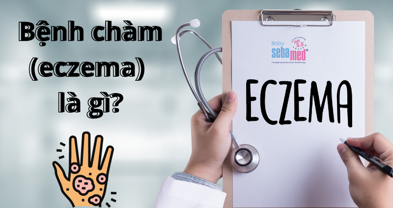 Bệnh chàm eczema là gì?