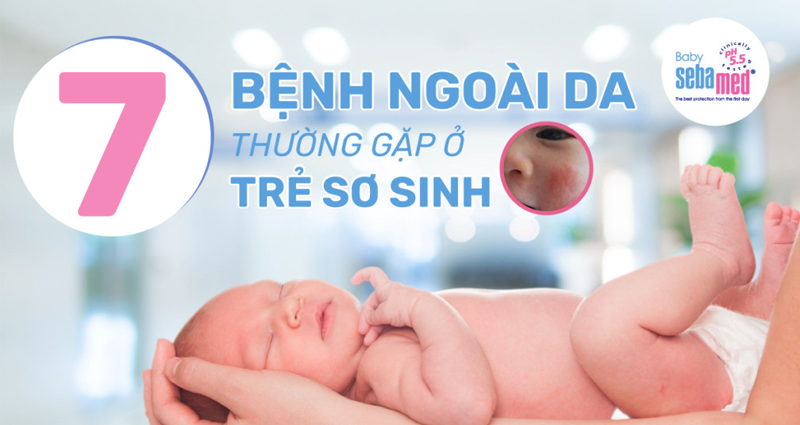 7 bệnh ngoài da ở trẻ sơ sinh thường gặp