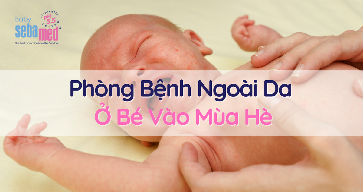 Phòng Bệnh Ngoài Da Ở Bé Vào Mùa Hè