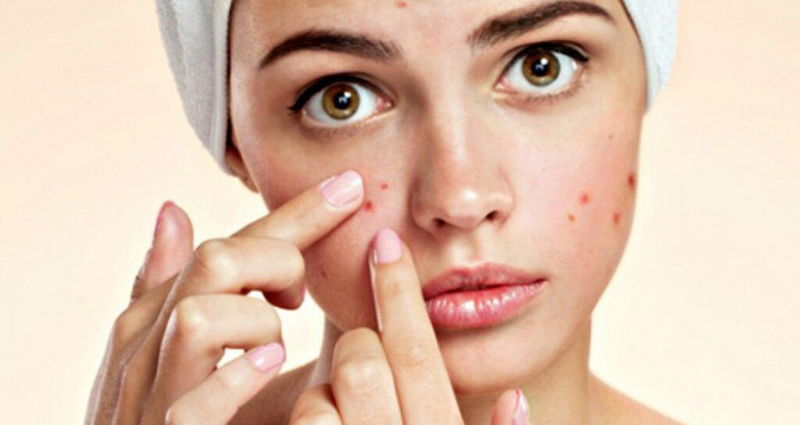 TOP 7+ cách trị mụn bọc tại nhà an toàn và hiệu quả