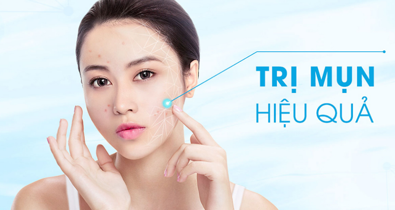 4 Mẹo Trị Mụn Hiệu Quả Dành Cho Da Hỗn Hợp Và Nhạy Cảm
