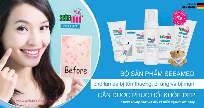 5 Bước Trị Mụn Hiệu Quả Từ Công Thức pH5.5