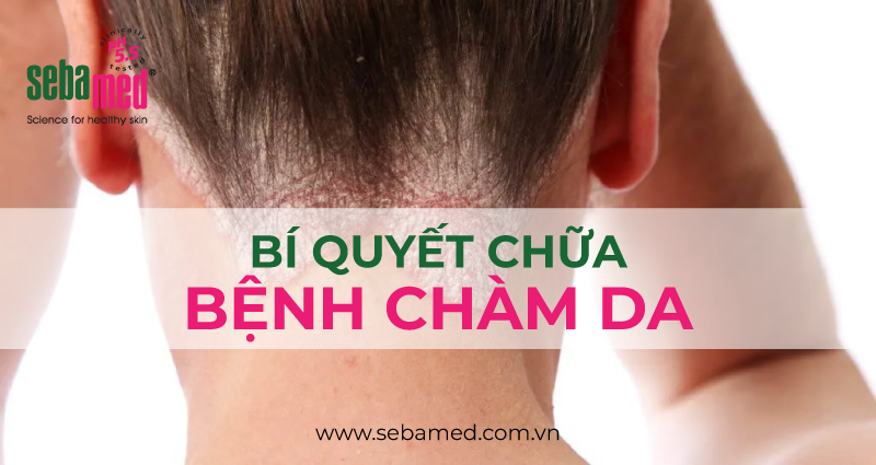 Bí Quyết Chữa Bệnh Chàm Da