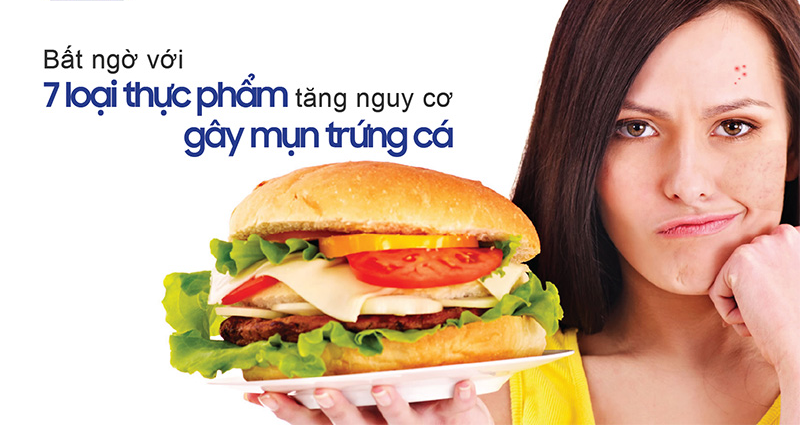 8 loại thực phẩm gây mụn bạn nên tránh xa