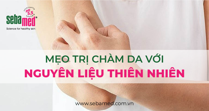 6 Cách trị chàm da theo phương pháp tự nhiên, dễ làm, ít tác dụng phụ