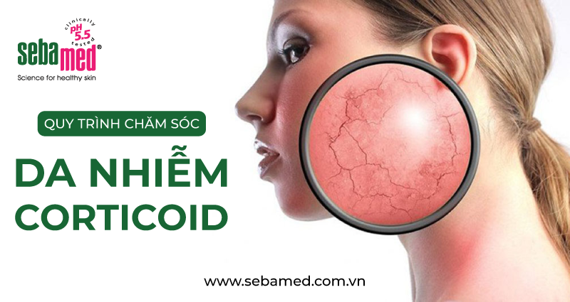 Quy trình chăm sóc da nhiễm Corticoid