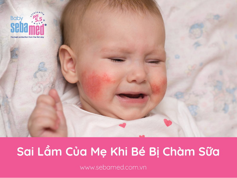5 Sai lầm của mẹ khi bé bị chàm sữa cần tránh