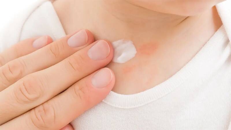 Bôi thuốc và kem dưỡng ẩm đều đặn, kĩ các nếp gấp ở da để bé nhanh khỏi chàm sữa.