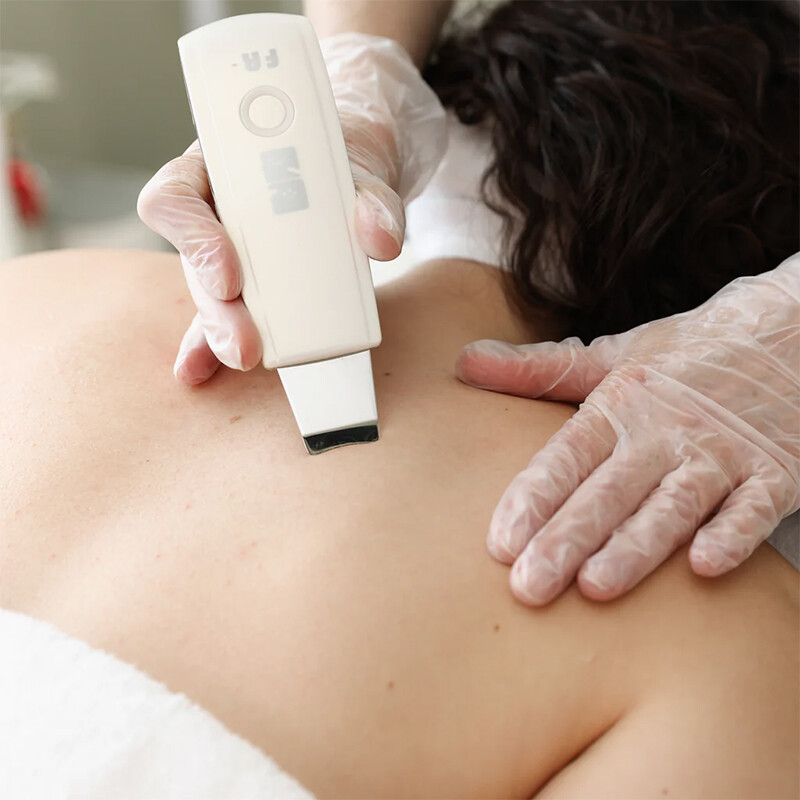 Áp dụng các biện pháp trị sẹo, thâm mụn lưng tại các cơ sở chuyên khoa hoặc thẩm mỹ viện.