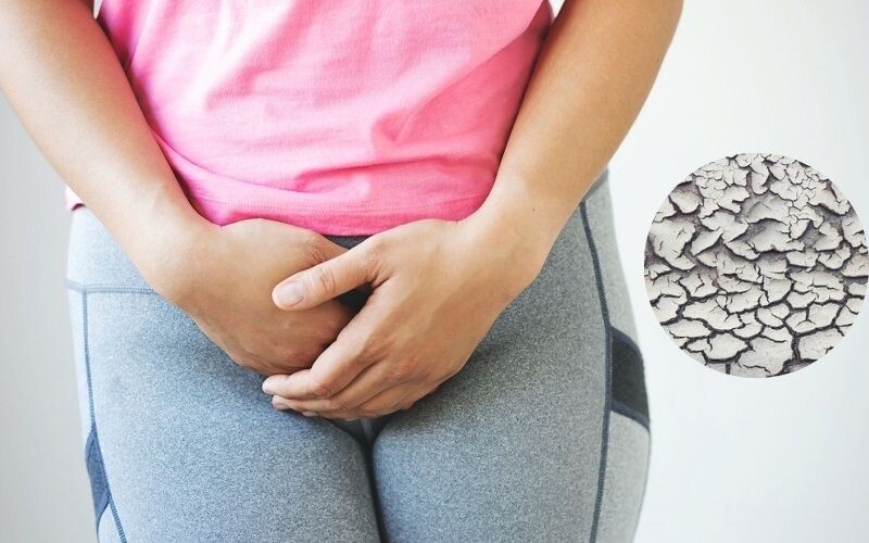 Bị nẻ vùng kín: Nguyên nhân và cách điều trị hiệu quả