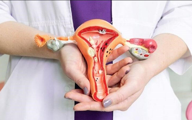 6+ các loại bệnh viêm nhiễm phụ khoa thường gặp