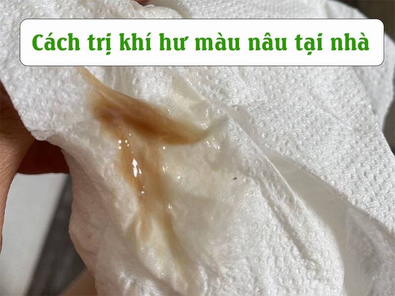 4 Cách trị khí hư màu nâu tại nhà đơn giản mà hiệu quả 3 - 3 Cách trị khí hư màu nâu tại nhà đơn giản mà hiệu quả.