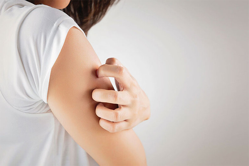 Lác đồng tiền: Nguyên nhân, dấu hiệu, cách điều trị chuẩn 4 - 4 Ngứa là một trong những triệu chứng nổi bật khi bị lác đồng tiền trên da.