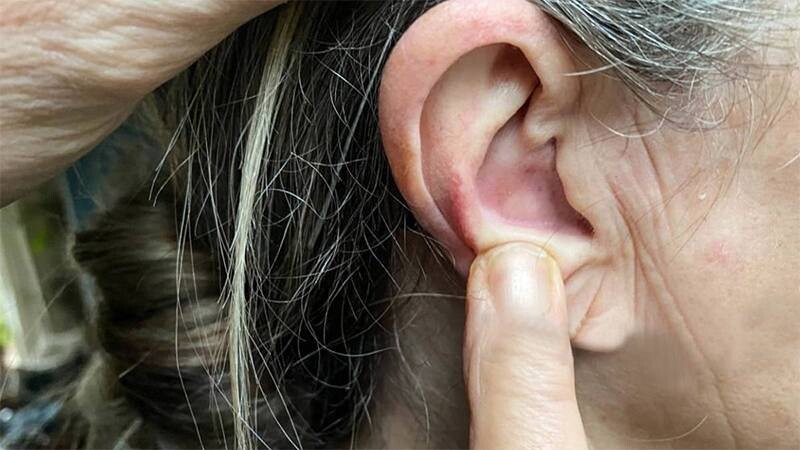 Mọc mụn ở tai đau nhức là bệnh gì? Có nguy hiểm không? 3 - 3 Mọc mụn ở tai đau nhức có nguy hiểm không?