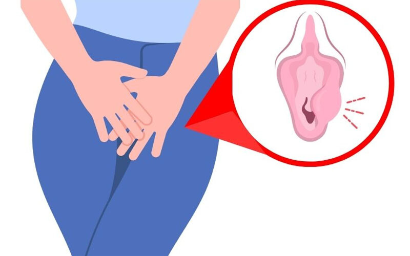 Môi bé bị sưng 1 bên vì sao? 3 - 3 Moi Be Bi Sung 1 Ben Co Nguy Hiem Khong