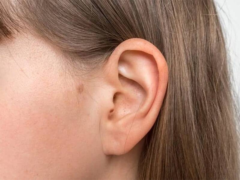 Mụn ở tai do đâu? Cách điều trị hiệu quả, an toàn 2 - 2 Mụn đầu đen là một trong các loại mụn ở tai phổ biến.