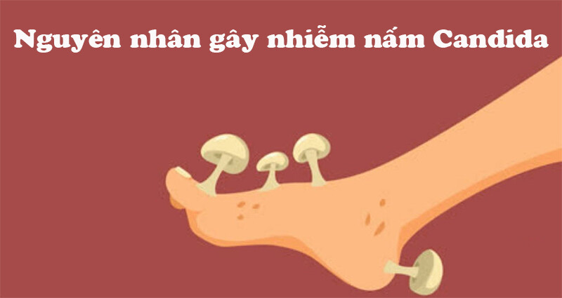 Nguyên nhân gây nhiễm nấm Candida trên da.