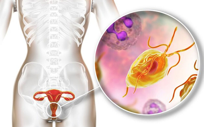 Vùng kín nổi mụn ngứa phải làm sao? Cách khắc phục 2 - 2 Nguyen Nhan Vung Kin Noi Mun Ngua