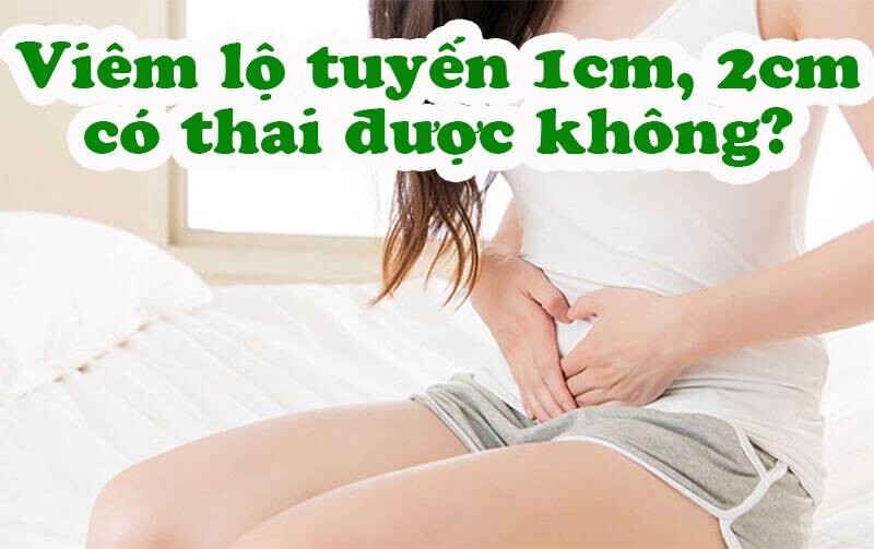 Viêm lộ tuyến có thai được không? 3 - 3 Viêm lộ tuyến 1cm, 2cm có thai được không?