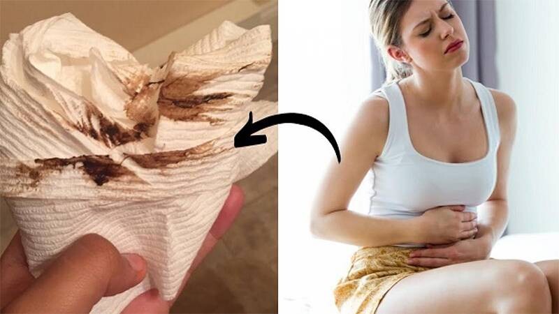 Các dấu hiệu ra nhiều khí hư do viêm nhiễm.