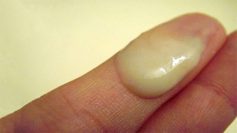 Cách trị khí hư màu vàng an toàn, nhanh khỏi.