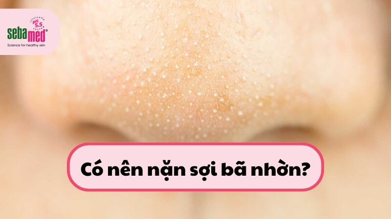 Có nên nặn sợi bã nhờn?